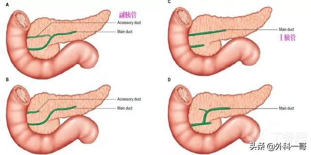 胰腺在人体的哪个部位图解(胰腺在人体的哪个部位图解视频)